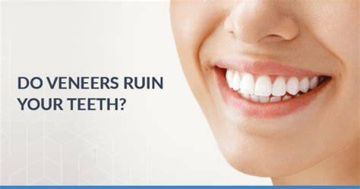 Don’t Ruin Your Teeth With Tooth Gems Stensland Dental Studio