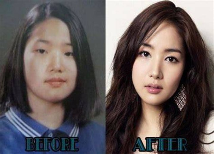 Pin auf Plastic Surgery Before and After