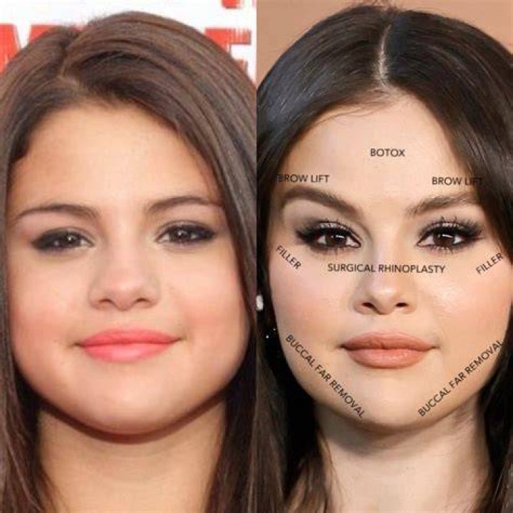 Selena Gomez Before and After A Skincare Journey