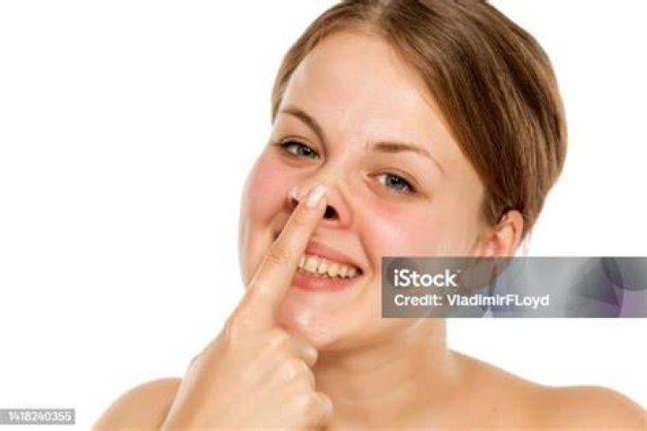 Woman Pressing Her Nose Stock Photo Image 33030712